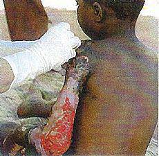 Elkartasun azoka igandean