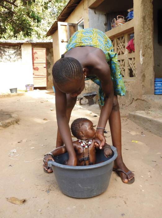 Senegalgo mediku kontsultategi baten aldeko bigarren eskuko azoka