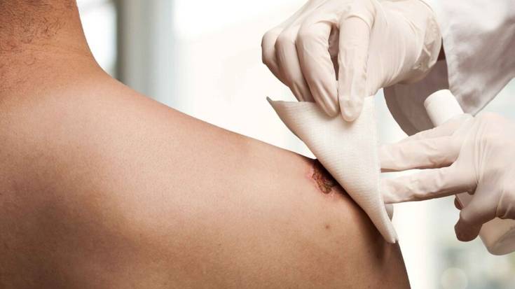 "Batez ere ohean edo gurpildun aulkietan daudenengan gertatzen da"